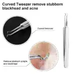 Facial Blackhead Remover Tweezers - Image 6