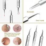 Facial Blackhead Remover Tweezers - Image 12