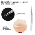 Facial Blackhead Remover Tweezers - Image 4